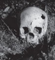 Picture of Adolph Ruth's Skull
