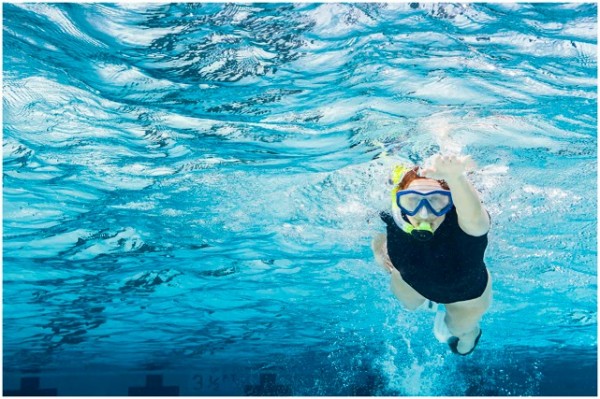 Brian Smale's Recent Series for Boston Scientific