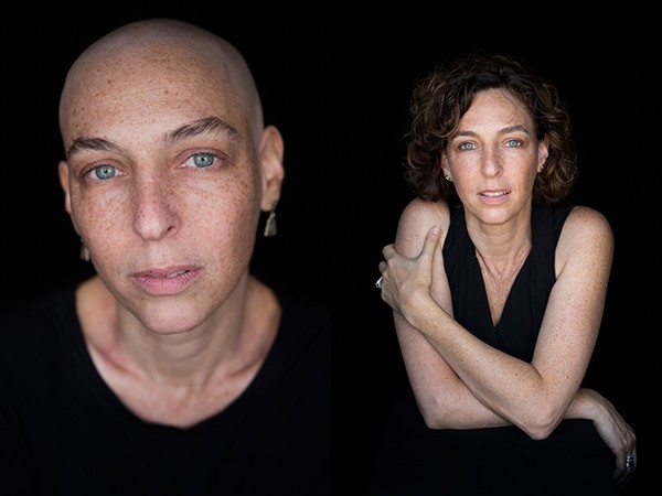 “Facing Chemo Before & After” To Be Shown In Switzerland This Summer
