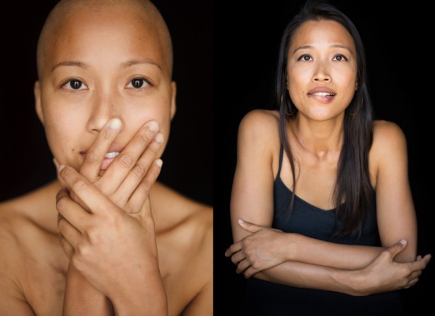 “Facing Chemo Before & After” To Be Shown In Switzerland This Summer
