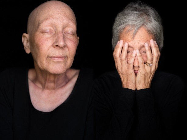 “Facing Chemo Before & After” To Be Shown In Switzerland This Summer
