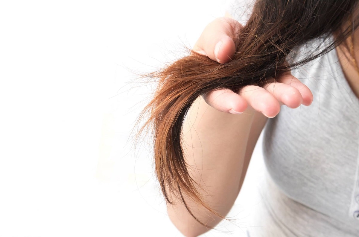 Queda de cabelo antes do casamento pode ser estresse!