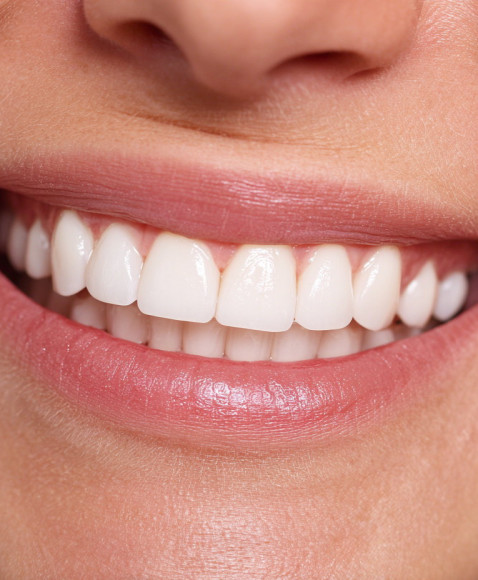 How to whiten teeth naturally (without spending a fortune)