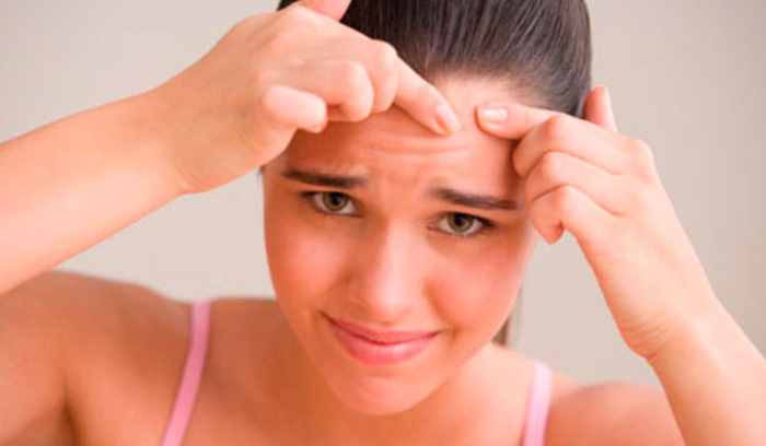best products for acne prone skin