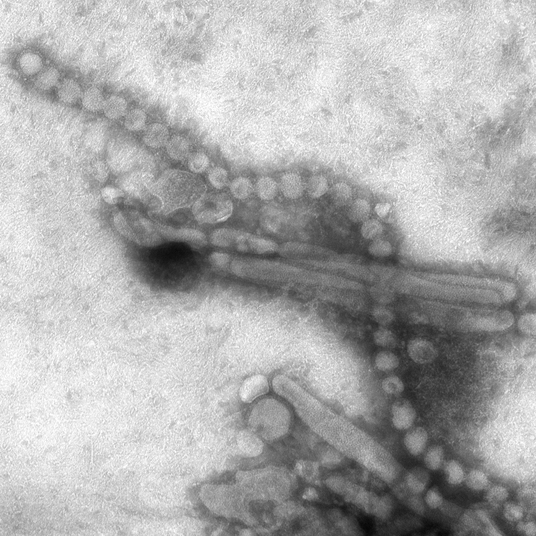 Doctor: Late winter flu increase possible