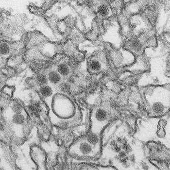 Alaska’s first Zika case is in Sitka