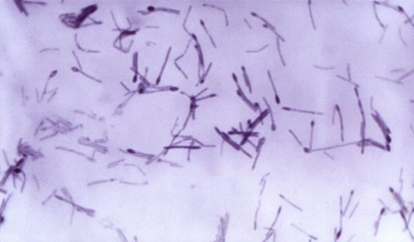 Science and cooking collide to fight botulism