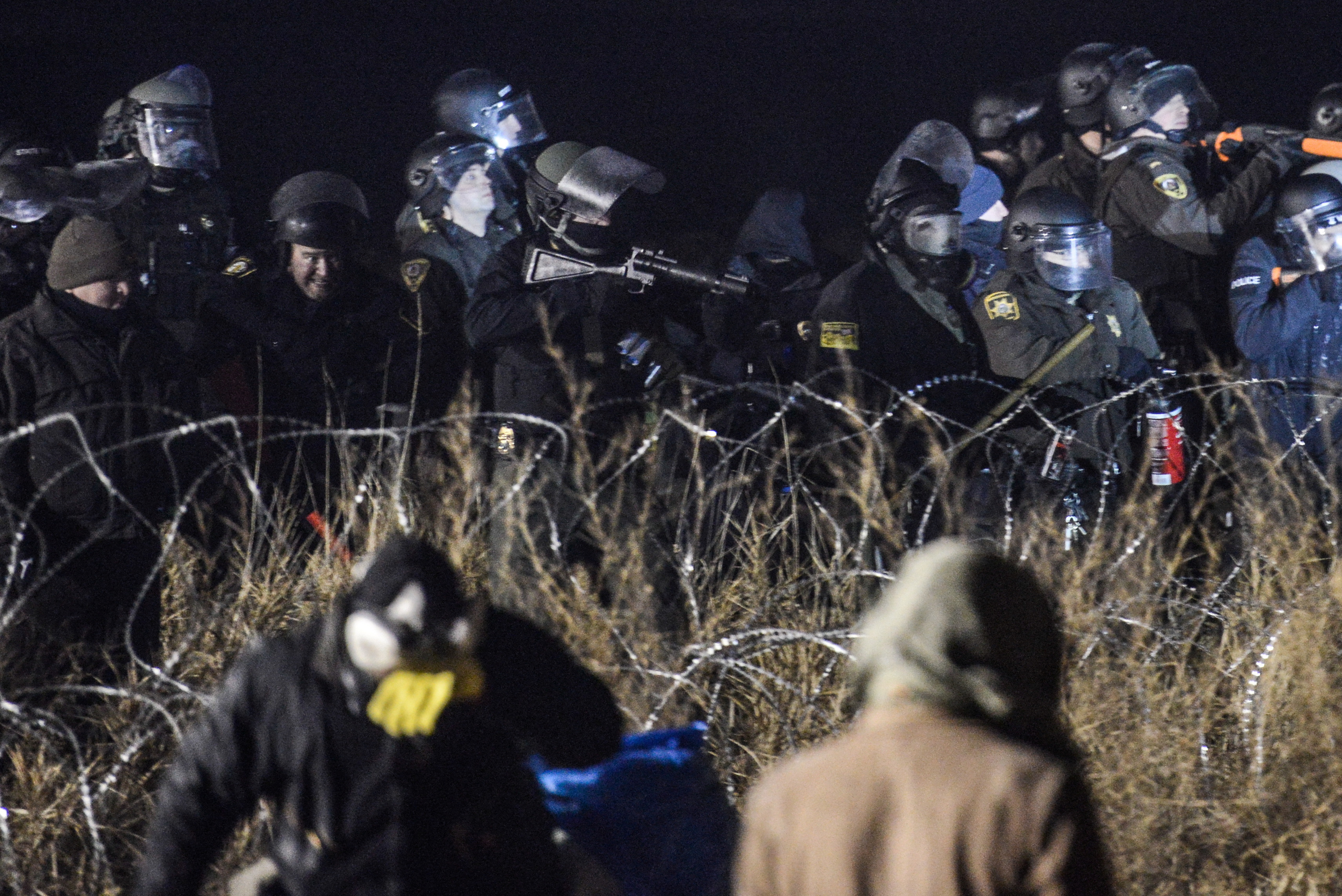 Woman injured at Standing Rock protest might lose arm, family says