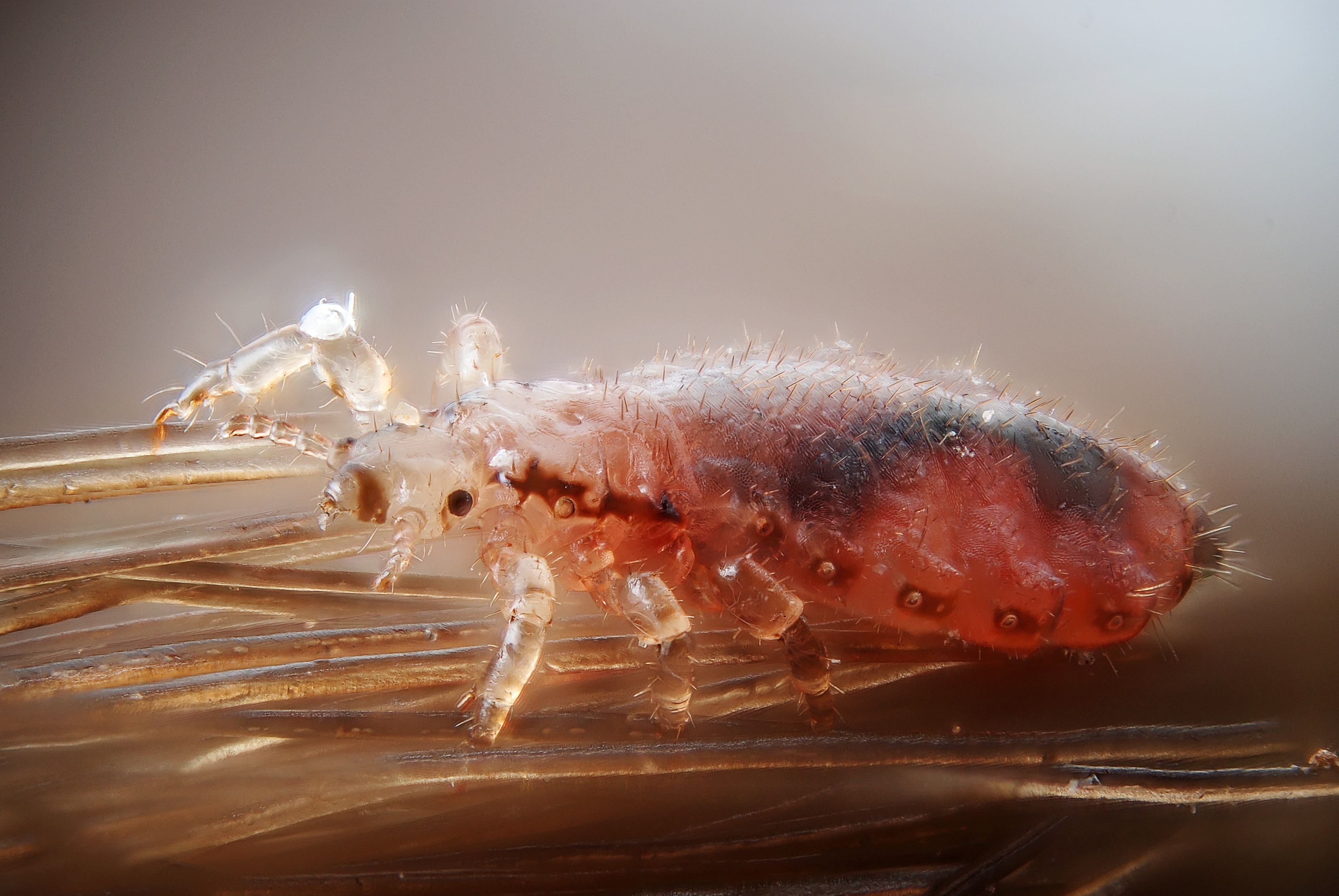 Are there head lice in Juneau schools? Yes, but …