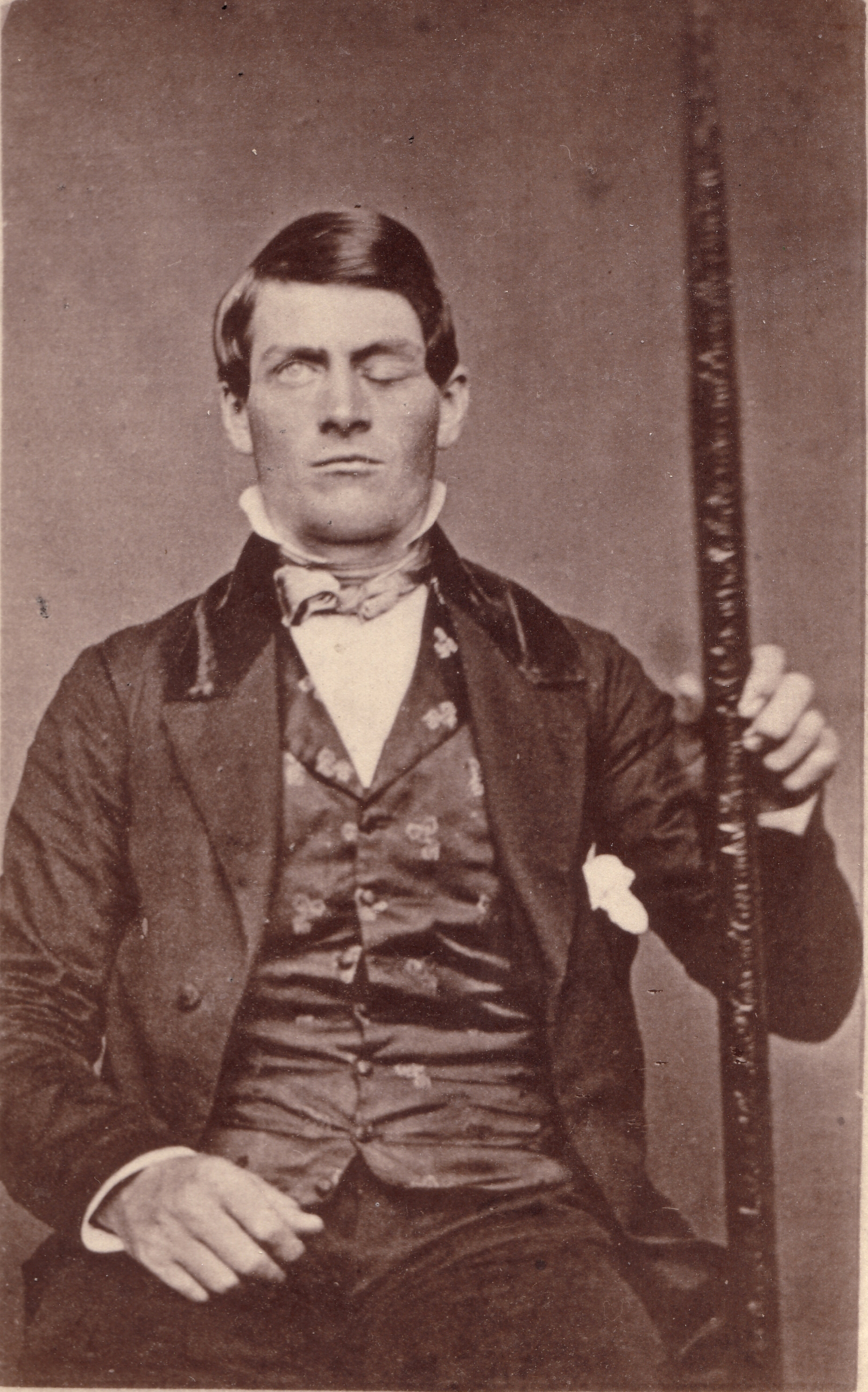 Why brain scientists are still obsessed with the curious case of Phineas Gage