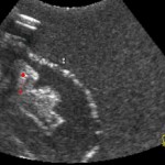 ultrasound image