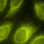 HeLa cells stained with an antibody against beta-tubulin.