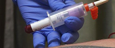 Gloved hand draws blood from patient with syringe