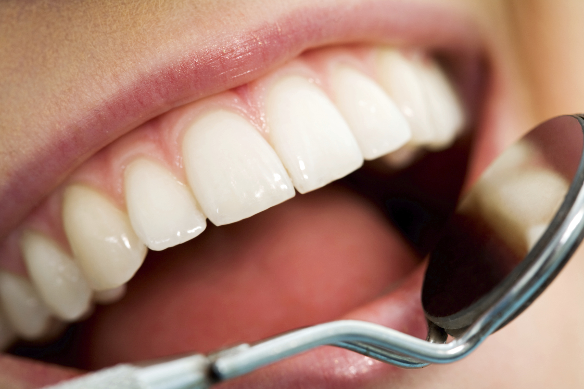 affordable dental implants