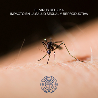 El virus del Zika - Impacto en la salud sexual y reproductiva