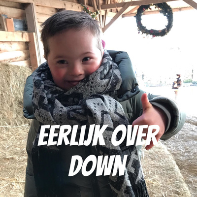 Eerlijk over Down 