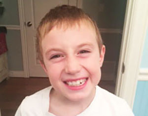 Teeth 112