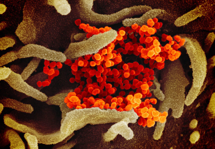 Coronavirus2