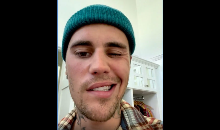 Bieber Paralysis