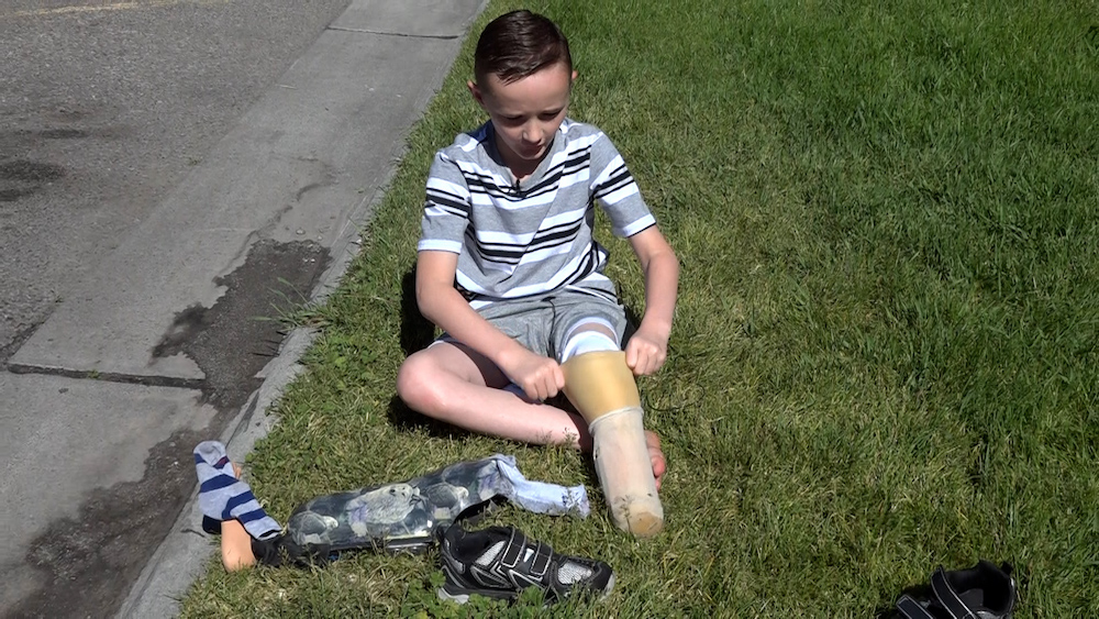 Boy living life to the fullest after being run over by lawnmower seven years ago - Vimarsana News