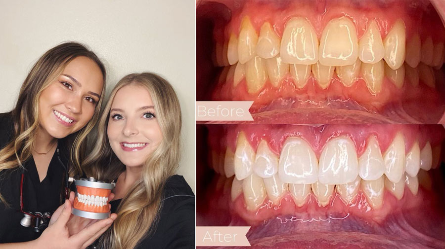 Biz Buzz Dental hygienists open teethwhitening business in Idaho