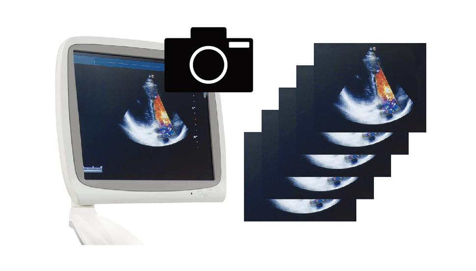 Take snapshots while recording!