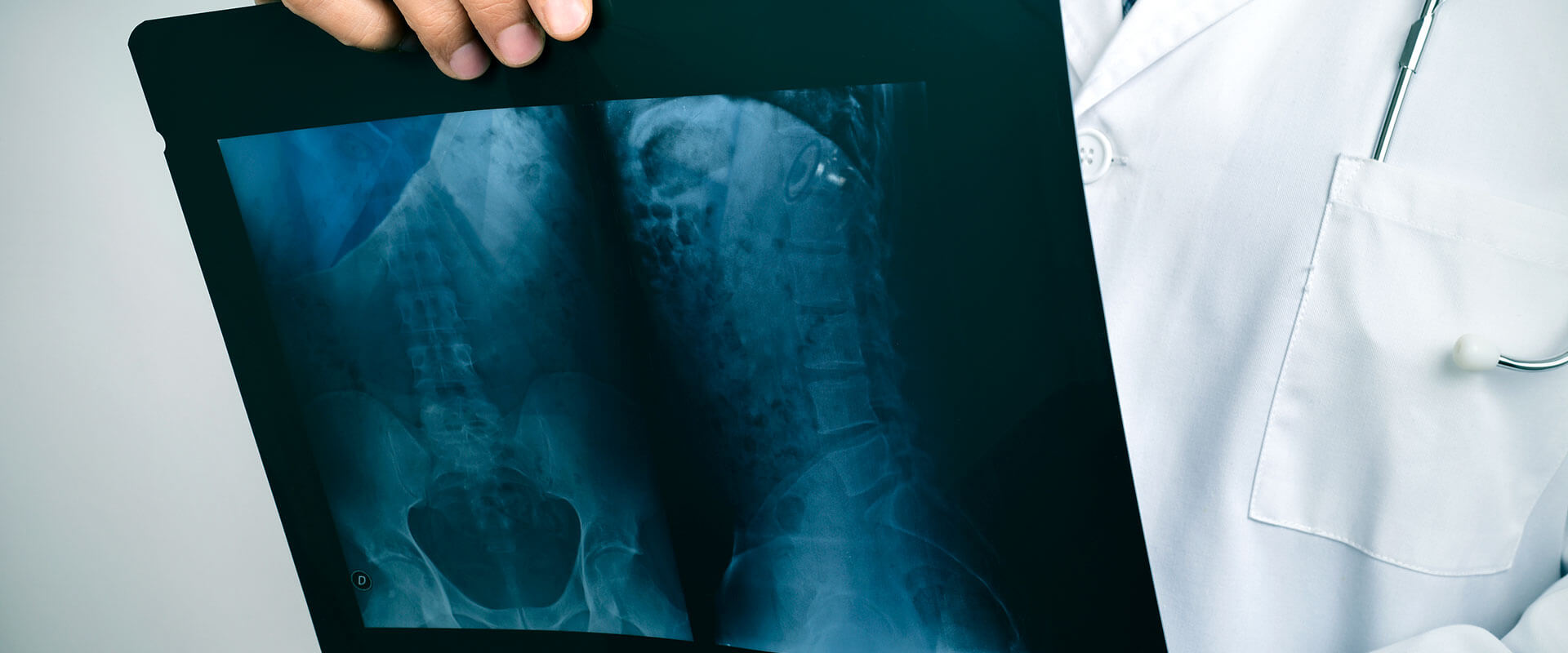 Doctor revisando una radiografía de rayos X sobre la columna vertebral.