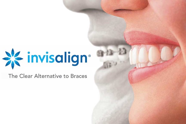 Invisalign