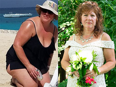 Woman on beach in swimsuit; same woman in a wedding dress holding flowers.