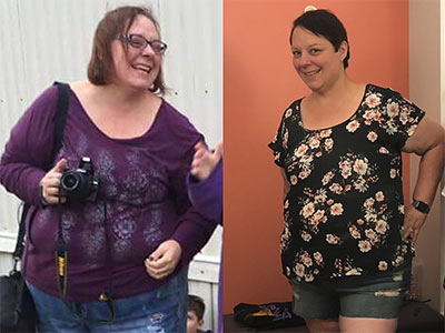 Side-by-side comparison of a woman before and after weight loss transformation.