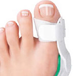 Bunions Bunions