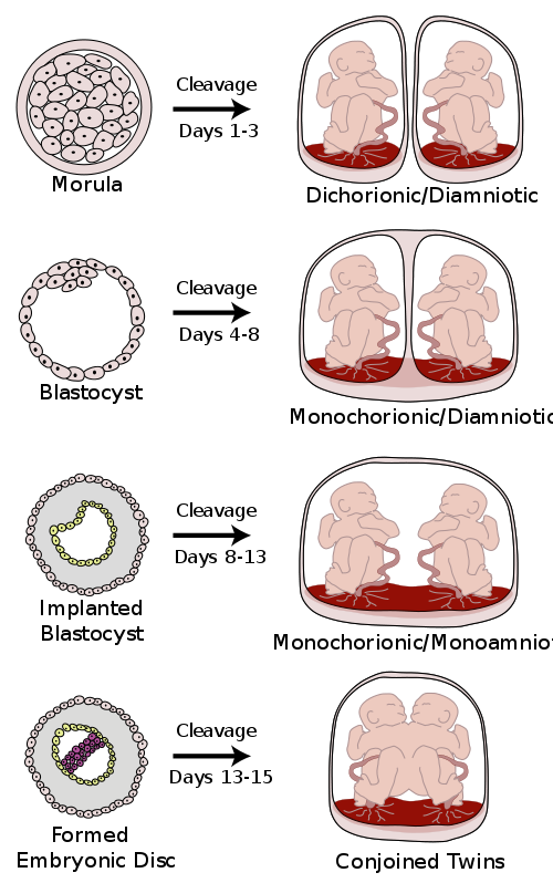 Diagram showing four ways monozygotic twins are formed, depending on the timing of the separation and duplication of cells. 1: Morula with cleavage at days 1 to 3 and results in dichorionic / diamniotic formation (separate placenta, separate amnion). 2: Blastocyst with cleavage at days 4 to 8 which results in monochorionic / diamniotic formation (sharing the same placenta but having separate amnions). 3: Implanted blastocyst with cleavage at days 8 to 13 results in monochorionic / mono amniotic (shared placenta and shared amnions). 4: Formed embryonic disc with cleavage at days 13 to 15 which in this figure leads to conjoined twins (shared placenta, shared amnions, and bodies fused).