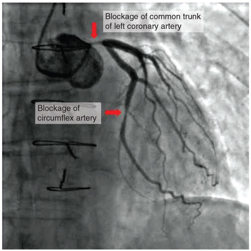 Heart Anatomy | Anatomy and Physiology II