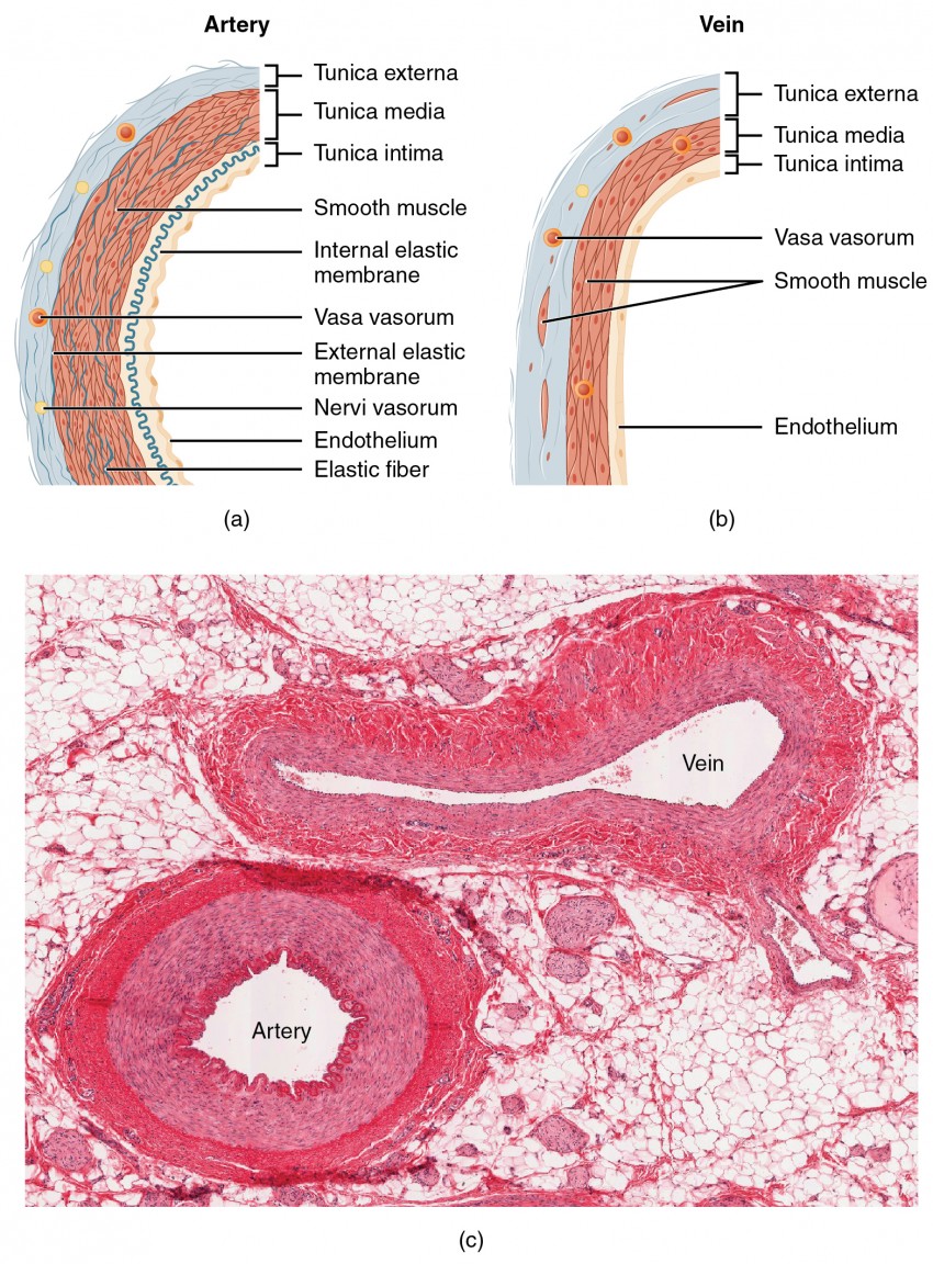 Gross image showing dilated and thick-walled blood vessels with