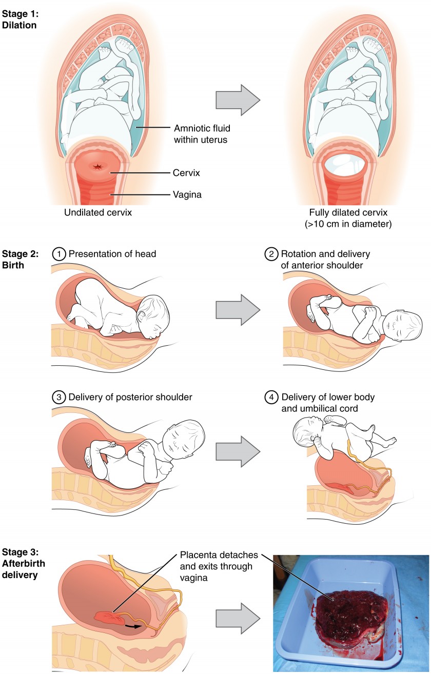 Pregnancy Cervix Dilation Chart