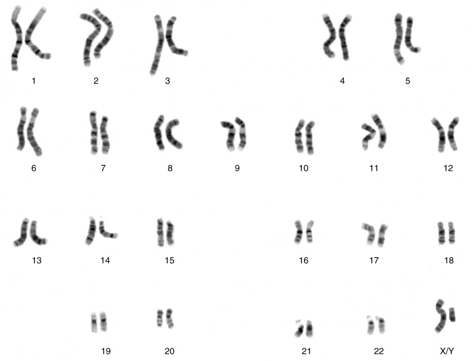 Patterns Of Inheritance Anatomy And Physiology Ii