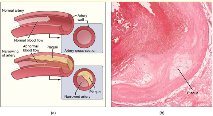 4 parts of the body impacted by high blood pressure - Vital Record