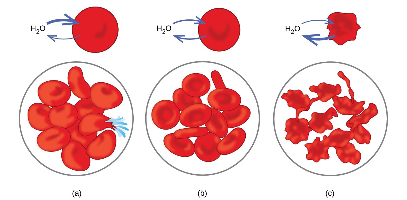 This figure shows three scenarios relating to red blood cell membranes. In a, H <a href=