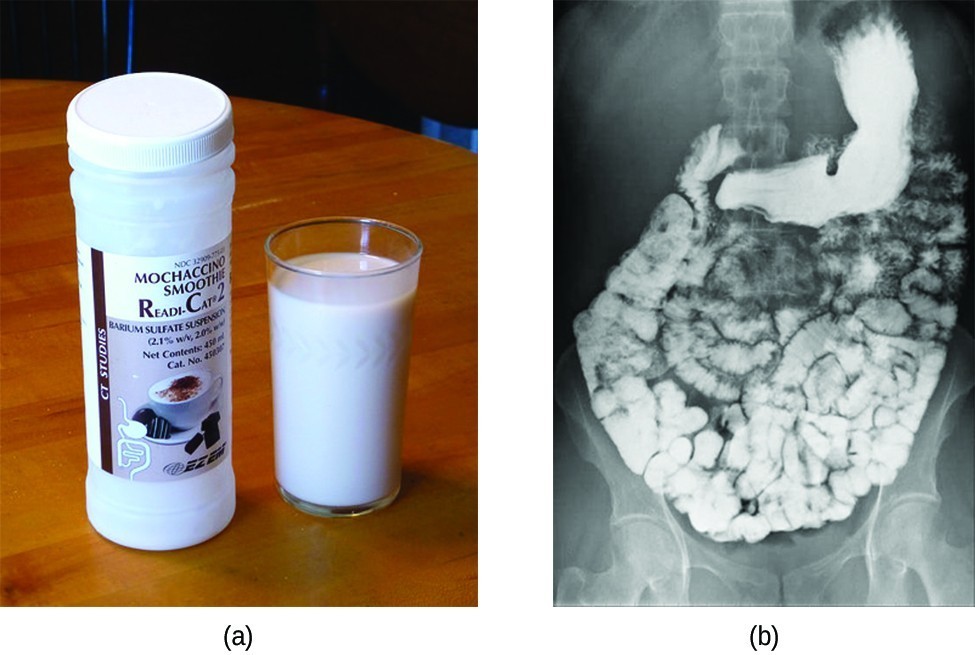 This figure contains one image. A black and white abdominal x-ray image is shown in which the intestinal tract of a person is clearly visible in white.