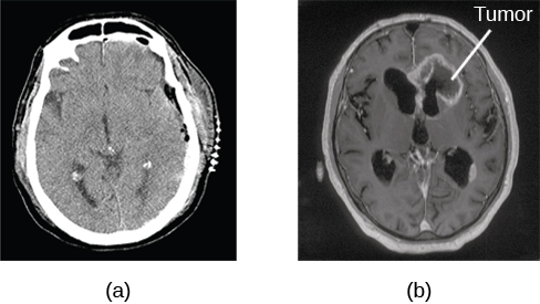 what does a ct scan show for dogs