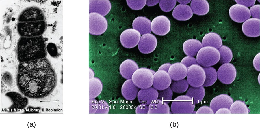 Figure a shows A TEM micrograph with a clear background and a dark cell in the center. A double line outlines the edge of the cell and webs of material inside the cell are visible. Figure b shows an SEM micrograph that has large purple clusters on a green background with small holes. The three dimensionality of the purple clusters is apparent.