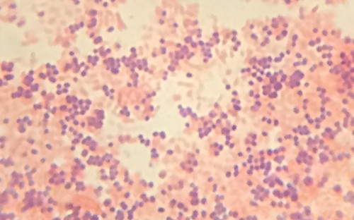 Staphylococcus aureus morphology visualised using Gram staining (10×