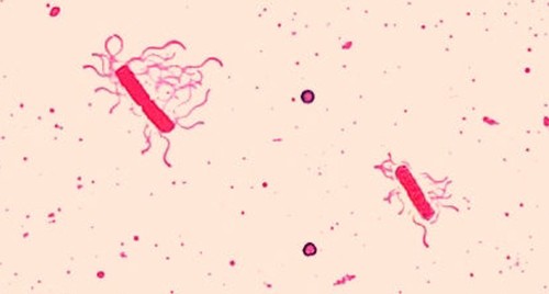 Staphylococcus aureus light microscopy. Morphology of Staphylococcus aureus  under the microscope. Micrograph of S.aureus, Gram stain. Gram-stained  smear from culture.