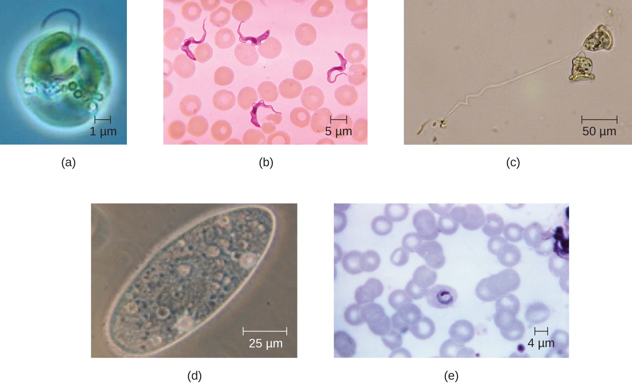 Unique Characteristics of Eukaryotic Cells | Microbiology