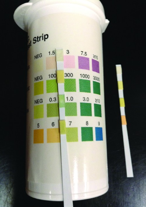 Bacterial Infections Of The Urinary System Microbiology