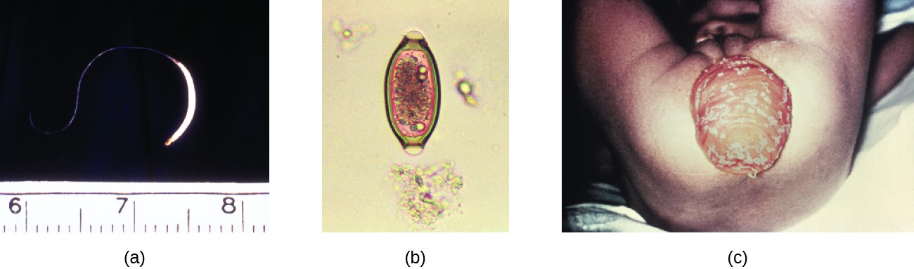 pinworm eggs visible