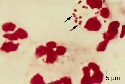 Nicrograph of small pink circles in pairs next to larger pink cells.