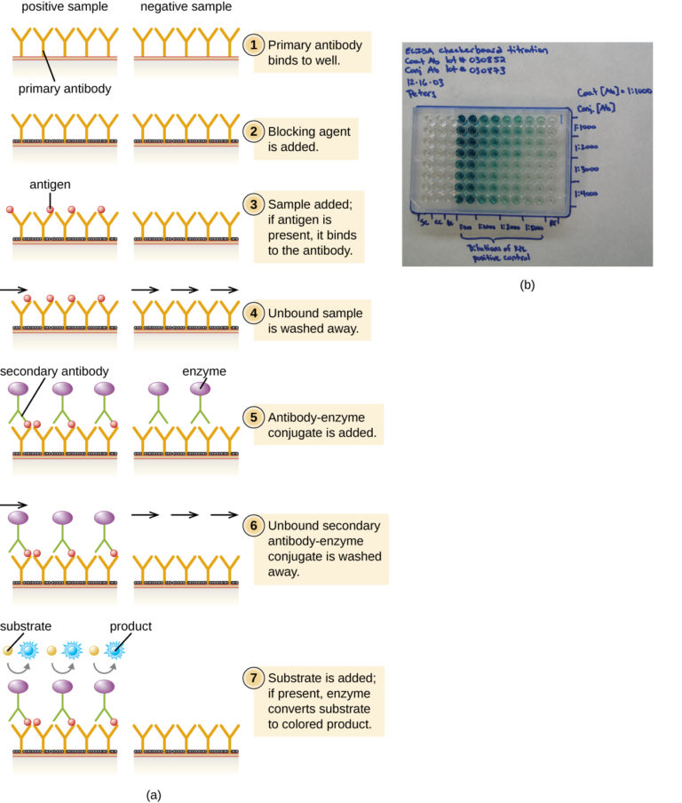 EIAs and ELISAs Microbiology