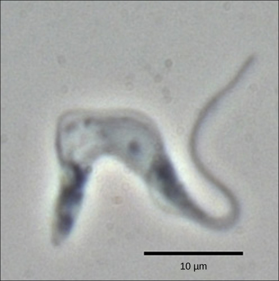 Il micrografo mostra T. brucei, che ha un corpo cellulare a forma di u e una lunga coda.