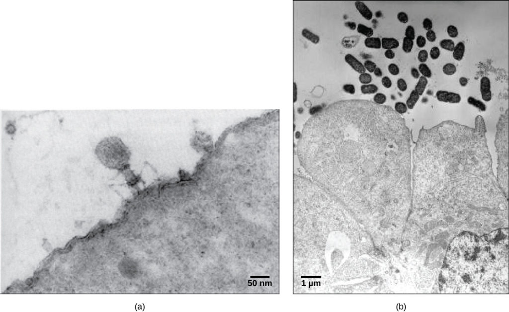 Micrograph A toont een virus met een zeshoekige kop die op dunne, gebogen benen staat. Het virus zit op het oppervlak van een cel die zo groot is dat slechts een klein deel van het oppervlak zichtbaar is. Micrograph b toont kleine bacteriële cellen die ongeveer de grootte van de organellen in de aangrenzende coloncellen zijn.